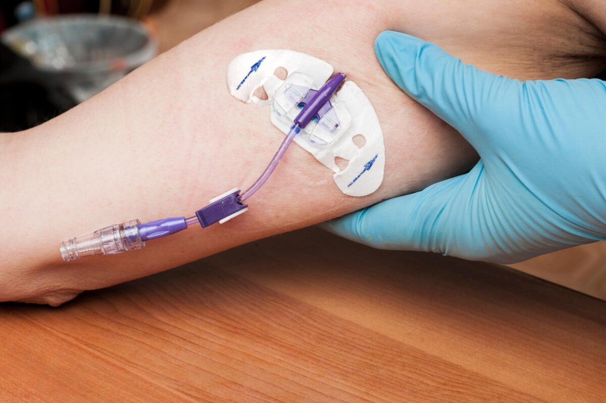 PICC line chemotherapie
