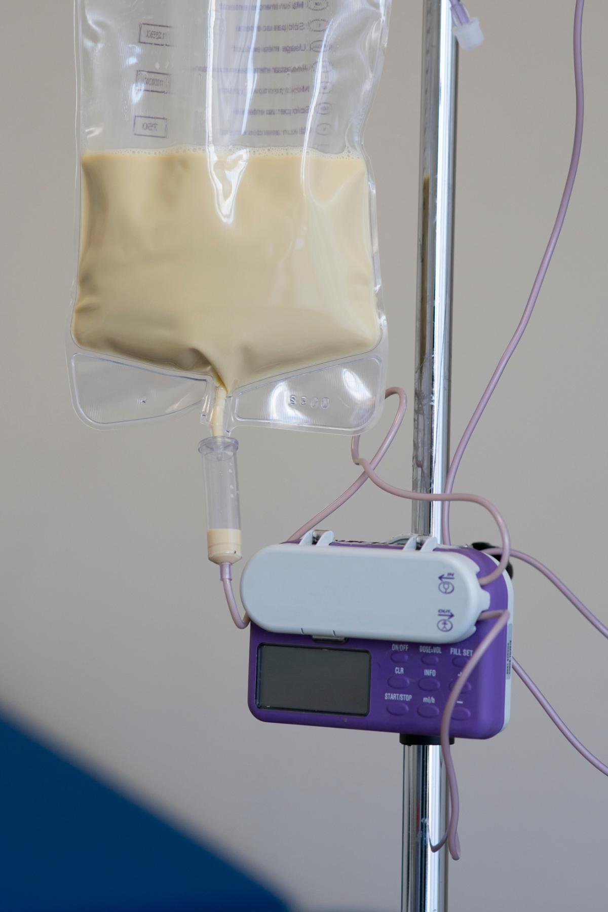 sondevoeding toedienen